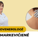 Vilma Markevičienė – gydytoja dermatovenerologė Vilniuje