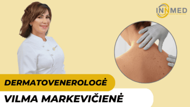 vilma-markeviciene-gydytoja-dermatovenerologe-vilniuje