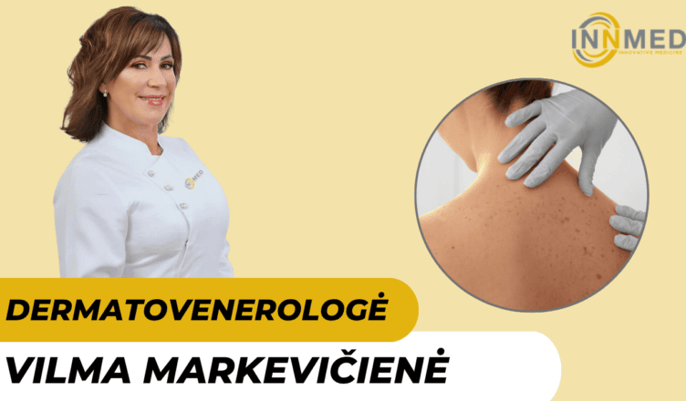 vilma-markeviciene-gydytoja-dermatovenerologe-vilniuje