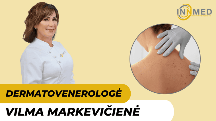 Vilma Markevičienė – gydytoja dermatovenerologė Vilniuje 1 vilma-markeviciene-gydytoja-dermatovenerologe-vilniuje